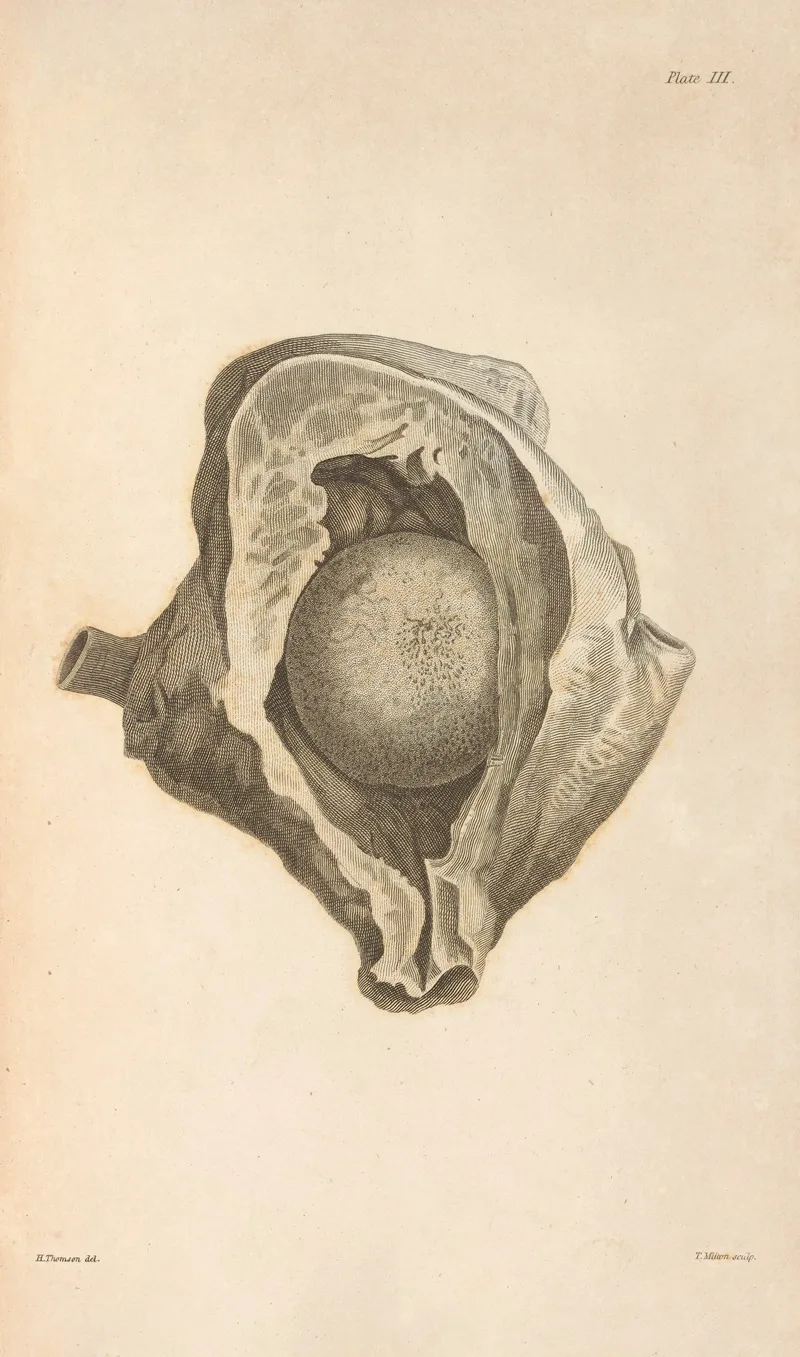 Alexander Marcet