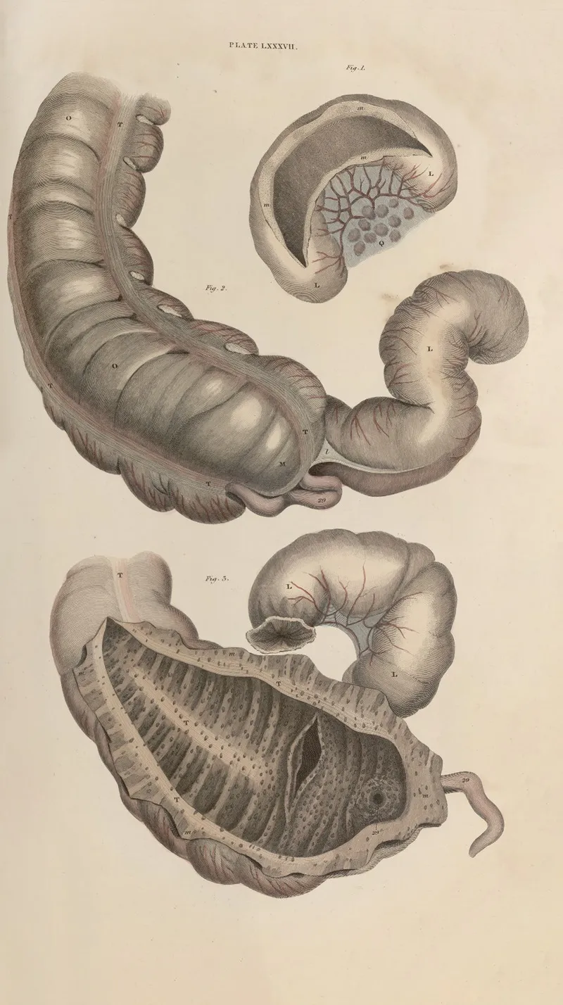A System Of Anatomical Plates Of The Human Body Pl 090 Wall Art by John Lizars - High-Resolution Digital Print