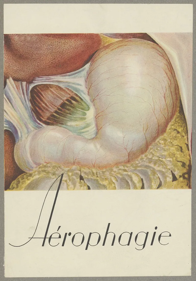 Aerophagie 2 Wall Art by Anonymous - High-Resolution Digital Print