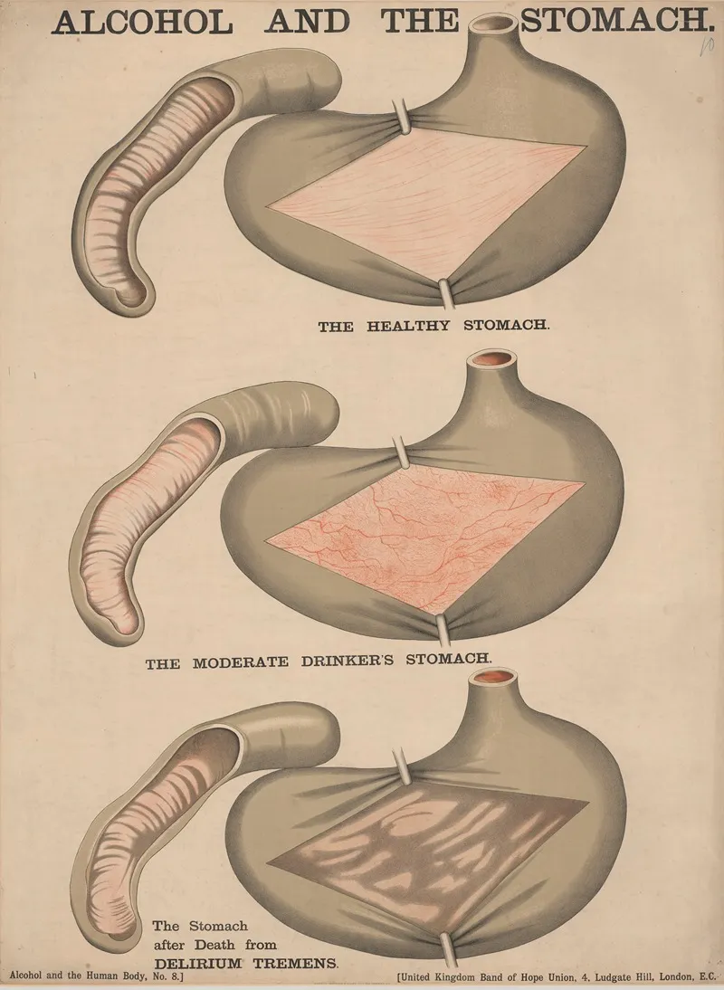 Alcohol And The Stomach Wall Art by Charles Wakely - High-Resolution Digital Print
