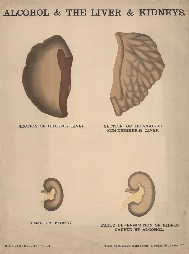 Alcohol The Liver Kidneys Wall Art by Charles Wakely - High-Resolution Digital Print
