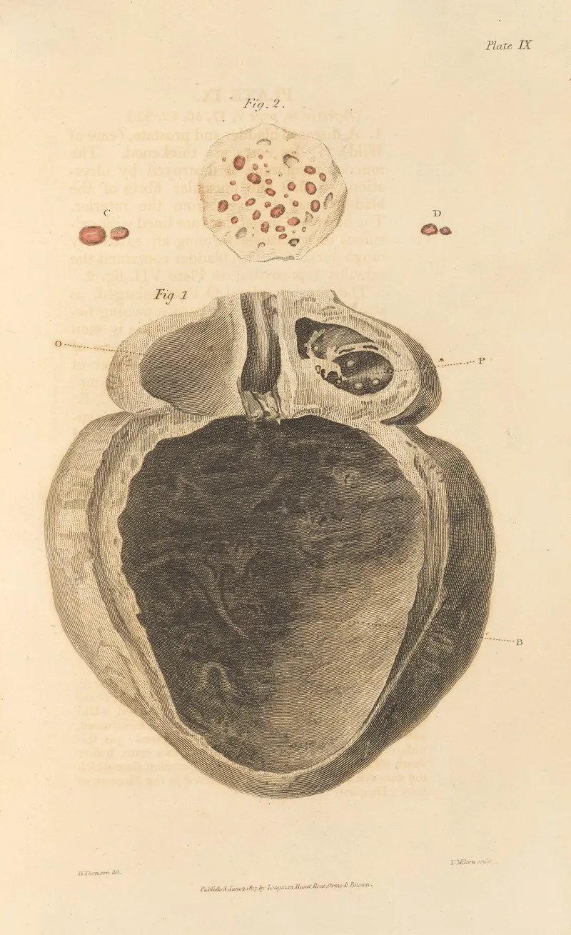 An Essay On The Chemical History And Medical Treatment Of Calculous Disorders Pl 6 Wall Art by Alexander Marcet - High-Resolution Digital Print