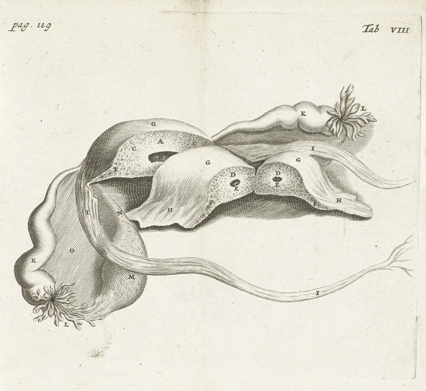 Anatomical Image Of An Ectopic Pregnancy 2 Wall Art by Hendrik Bary - High-Resolution Digital Print