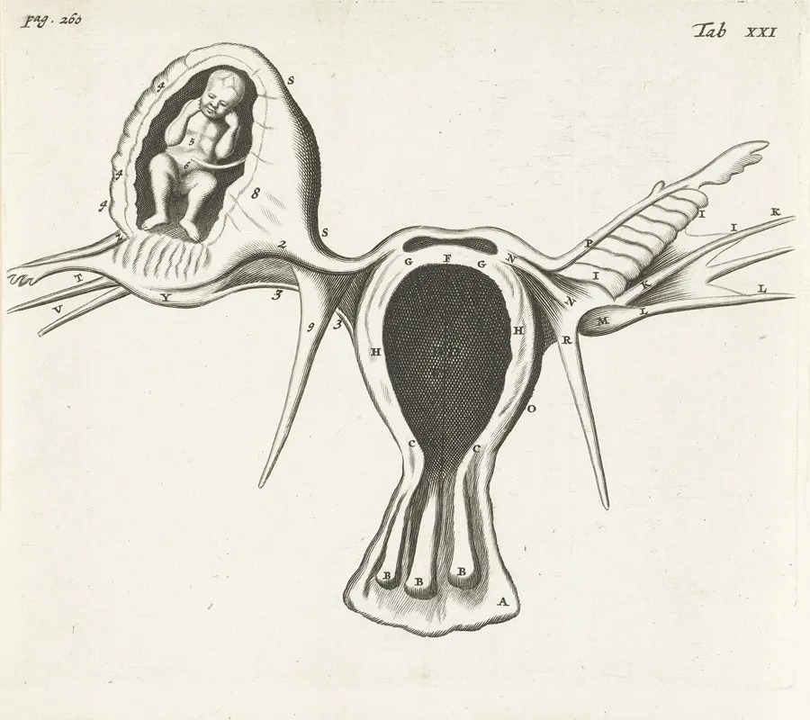 Anatomical Image Of An Ectopic Pregnancy Wall Art by Hendrik Bary - High-Resolution Digital Print