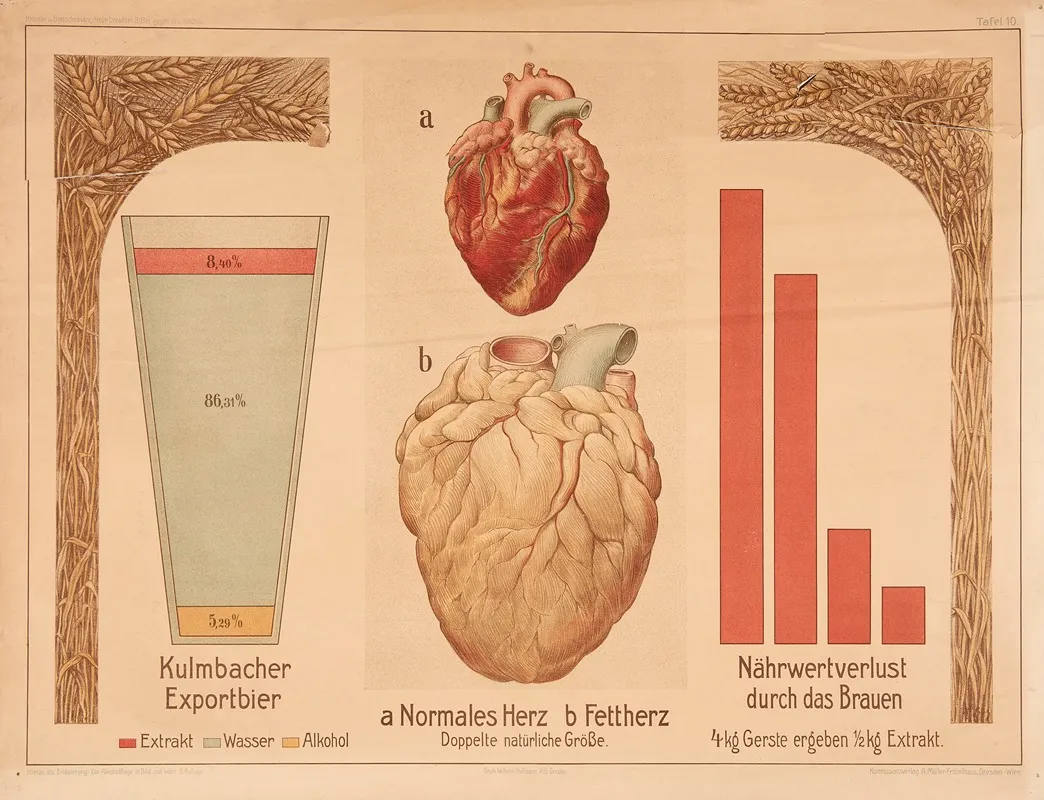 Beer Normal Heart And Fatty Heart Wall Art by Wilhelm Hoffmann, A.G. - High-Resolution Digital Print
