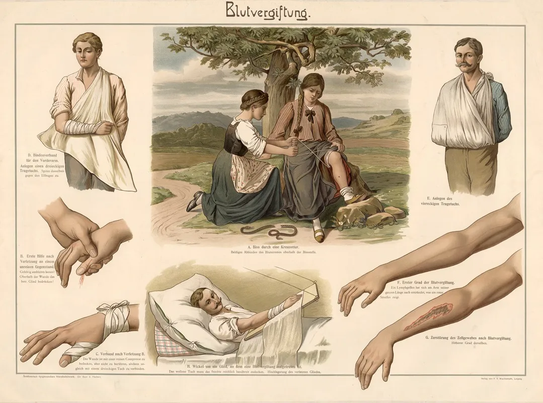Blood Poisoning Wall Art by Dr. Kolb-Stuttgart - High-Resolution Digital Print