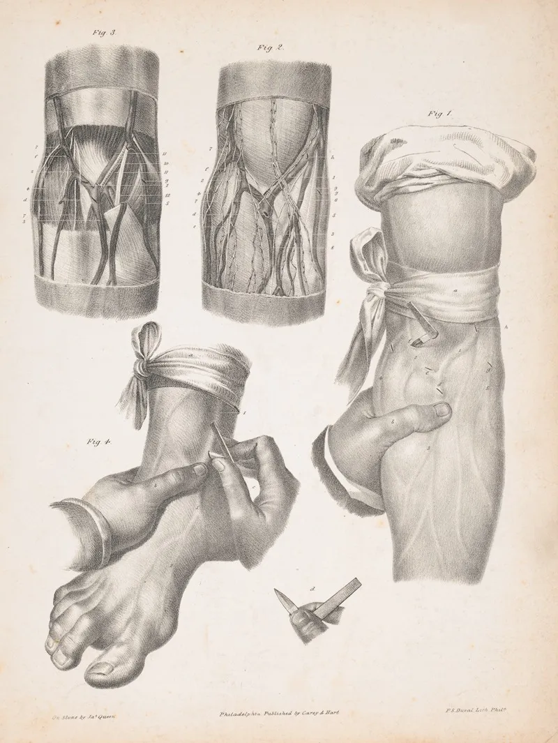 Blood Vessels In An Arm And A Foot With Two Sections Of An Arm Or Leg Showing The Anatomy Beneath The Skin