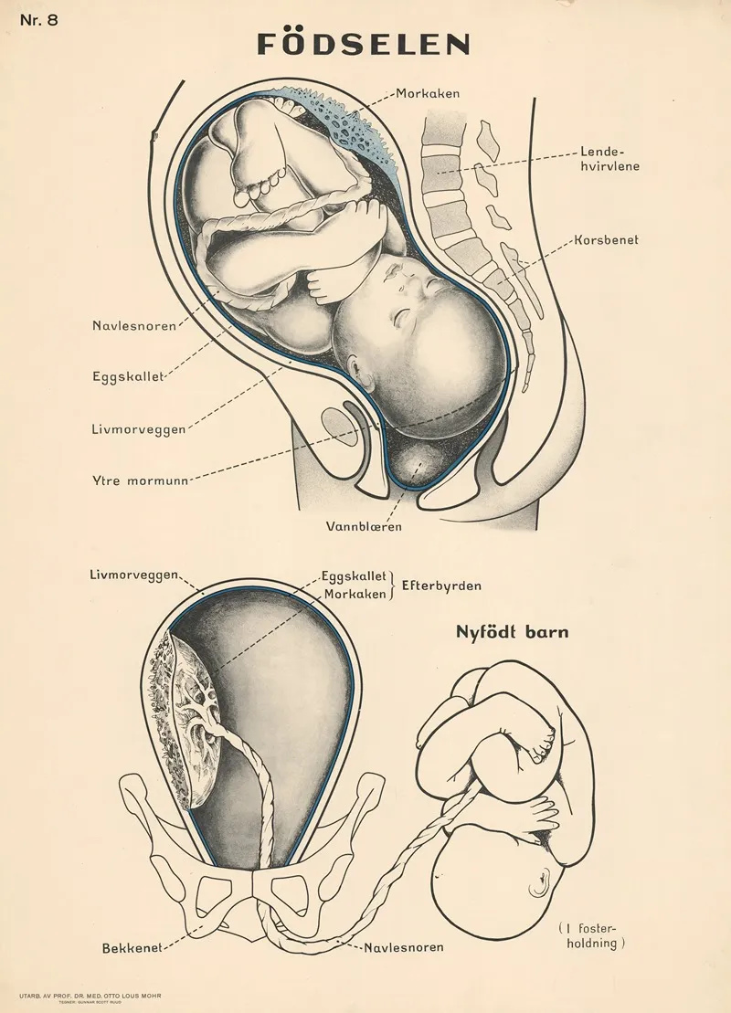 Childbirth