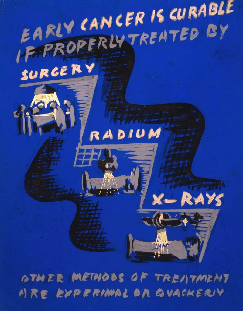 Early Cancer Is Curable If Properly Treated By Surgery Radium X Rays Wall Art by Anthony Velonis - High-Resolution Digital Print