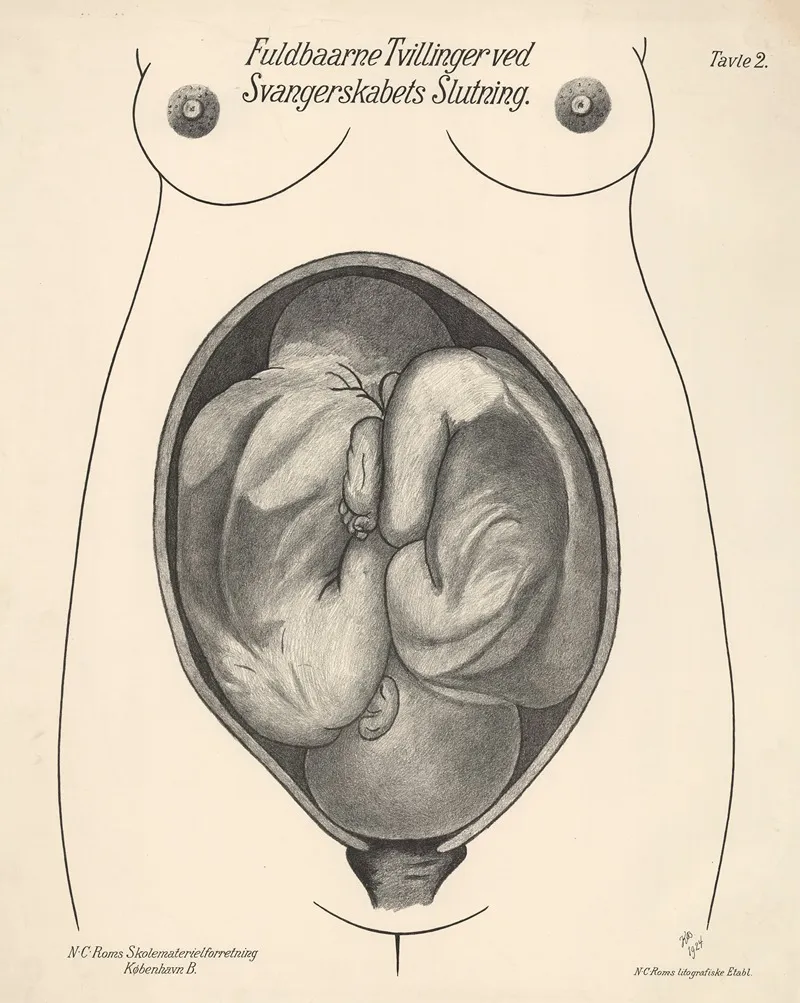 Full Term Twins At The End Of Pregnancy Wall Art by N.C. Rom - High-Resolution Digital Print