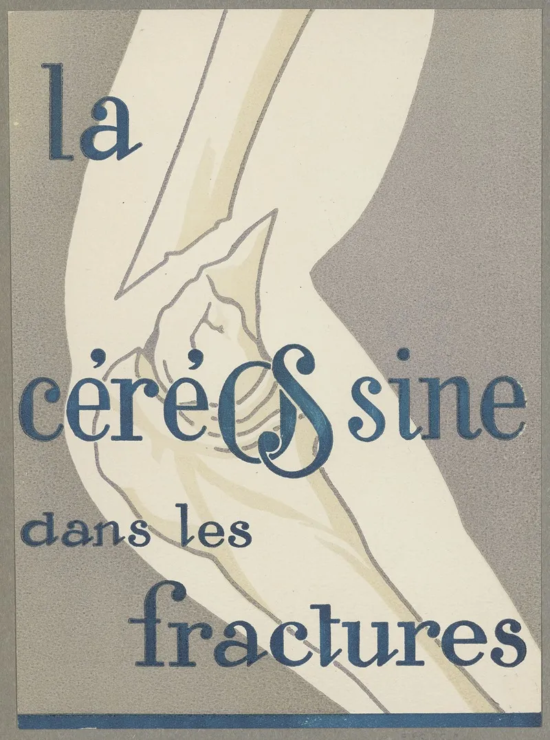 La Cereosine Dans Les Fractures