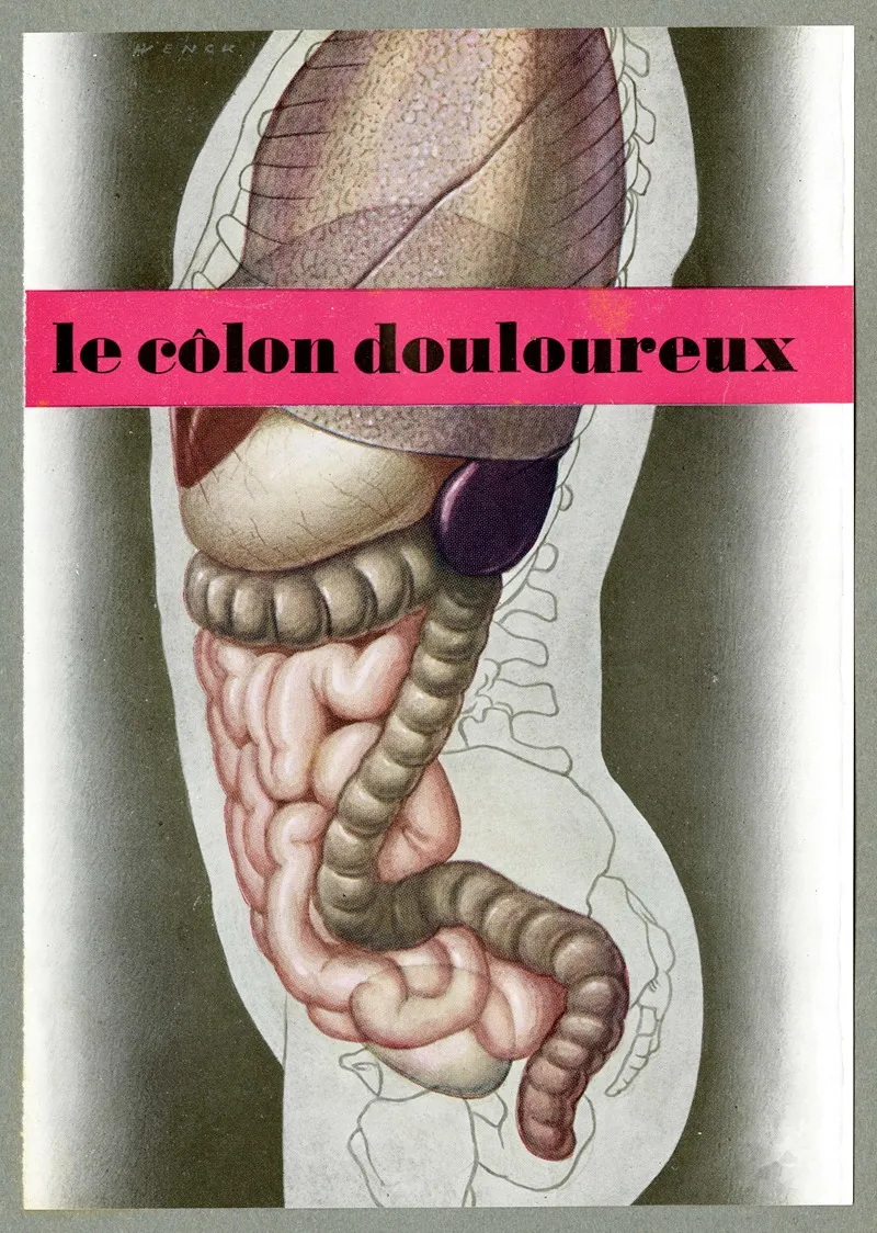 Le Colon Douloureux Wall Art by Wenck - High-Resolution Digital Print