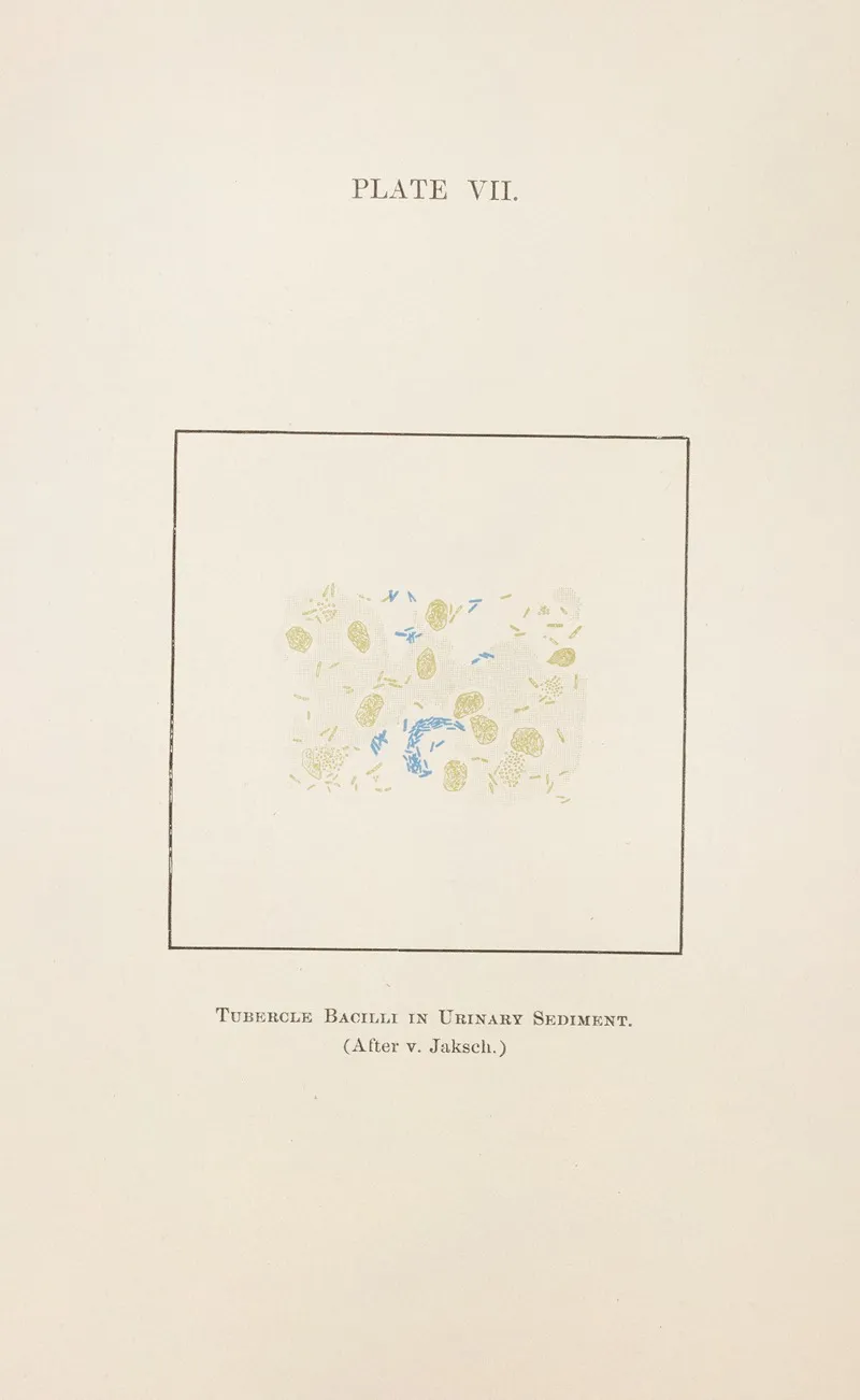 Plate Vii Tubercle Bacilli In Urinary Sediment Wall Art by Charles Wesley Purdy - High-Resolution Digital Print