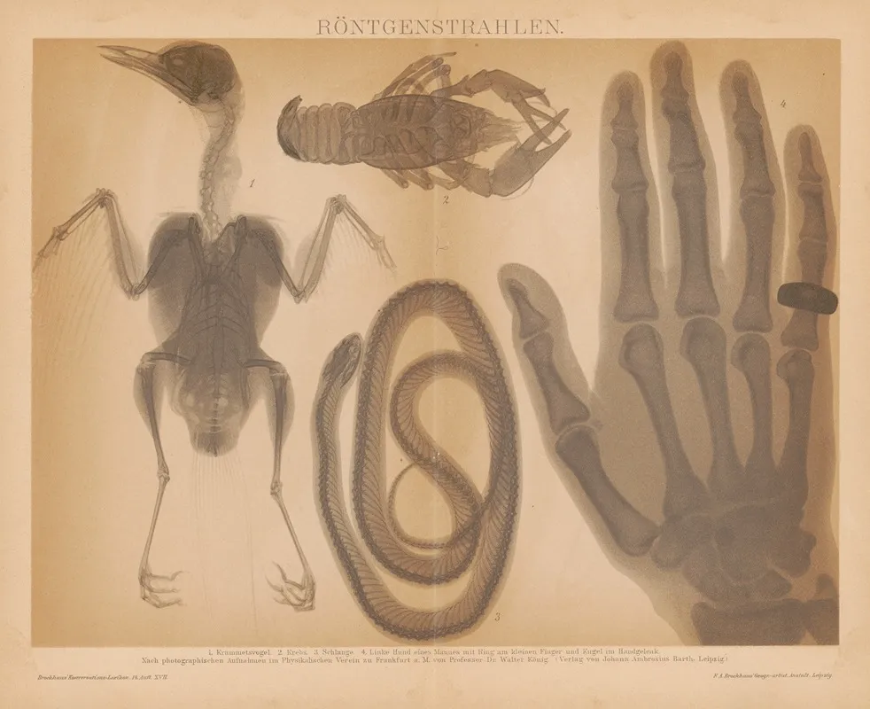 Rontgenstrahlen Wall Art by F.A. Brockhaus - High-Resolution Digital Print