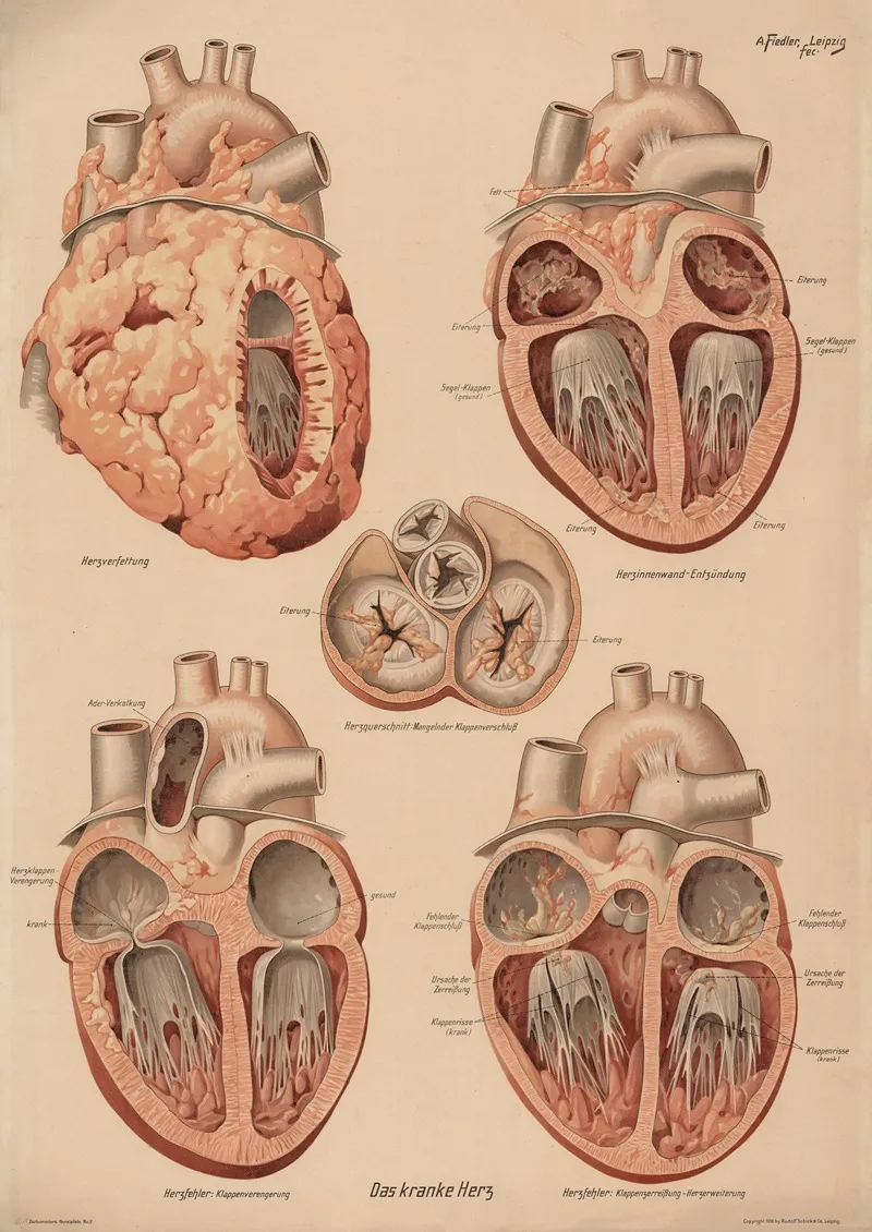 Sick Heart