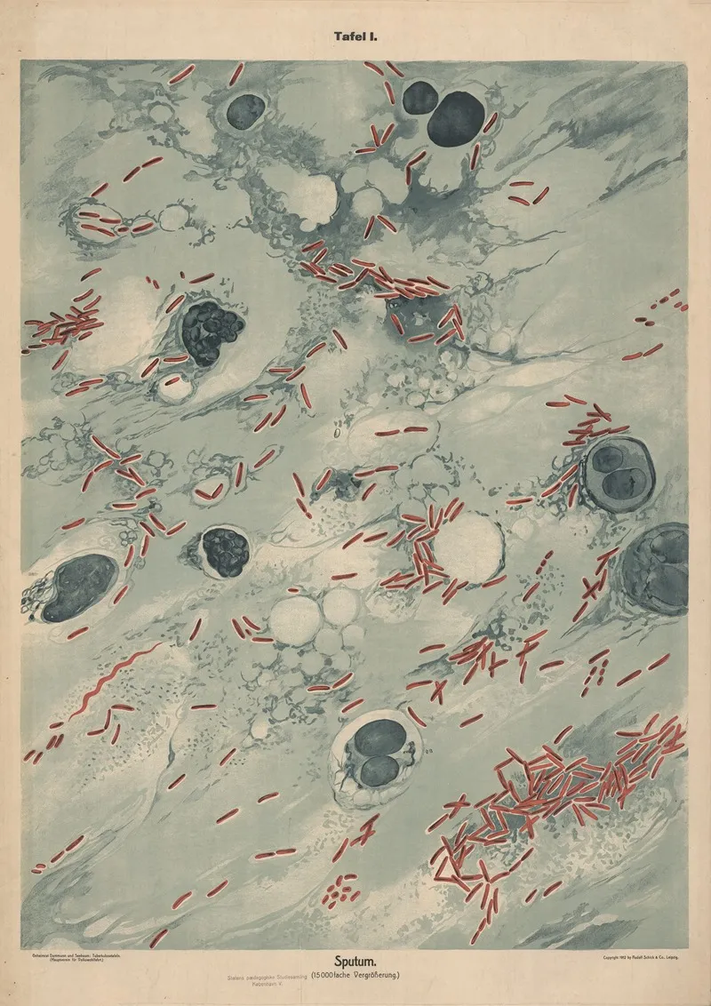 Sputum
