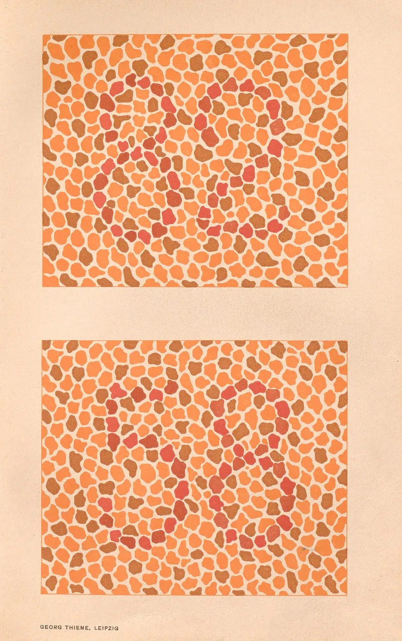 Stillings Pseudo Isochromatic Plates For Testing Color Perception Pl 22 Wall Art by Jakob Stilling - High-Resolution Digital Print