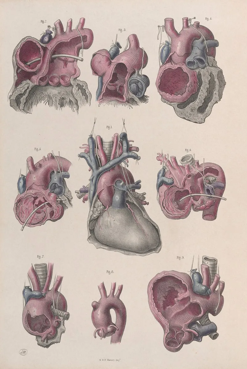 Surgical Anatomy Pl 14 Wall Art by Joseph Maclise - High-Resolution Digital Print