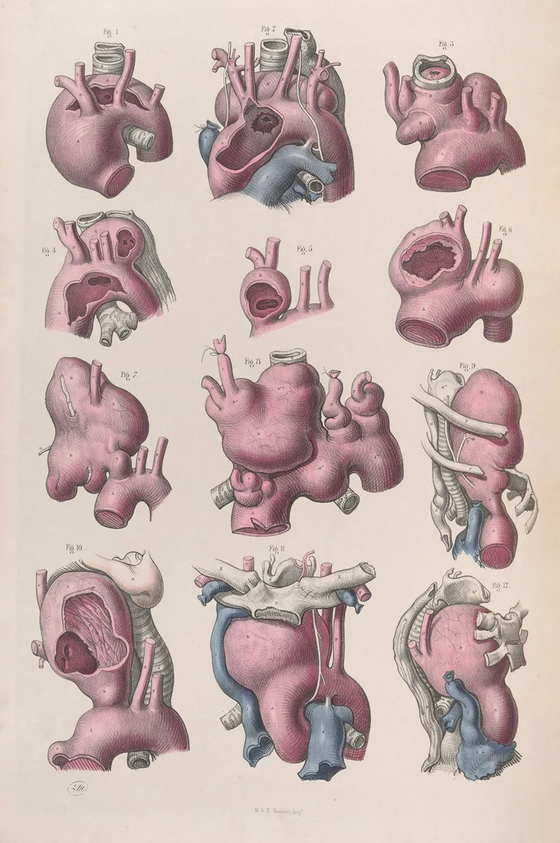 Surgical Anatomy Pl 16 Wall Art by Joseph Maclise - High-Resolution Digital Print