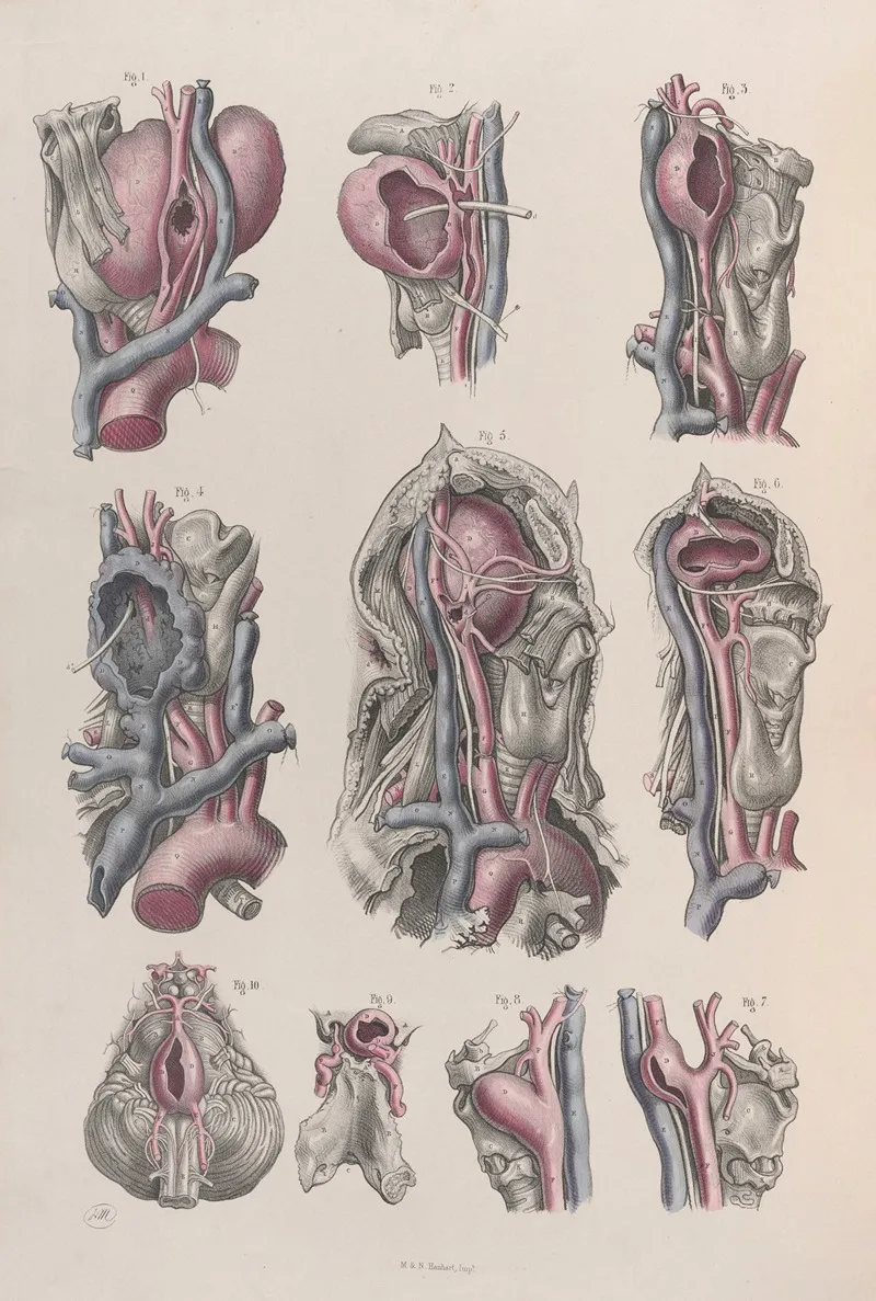 Surgical Anatomy Pl 17 Wall Art by Joseph Maclise - High-Resolution Digital Print