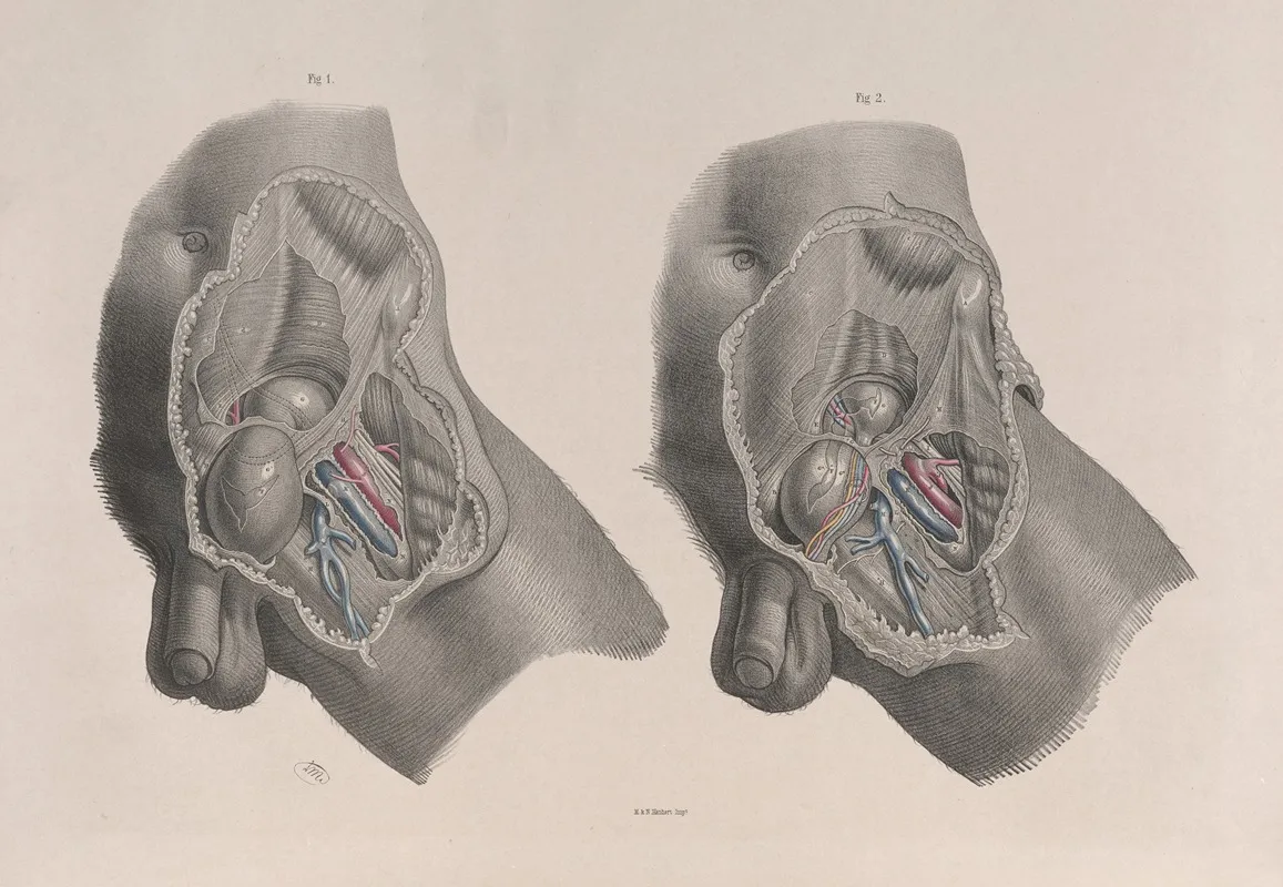 Surgical Anatomy Pl 30 Wall Art by Joseph Maclise - High-Resolution Digital Print