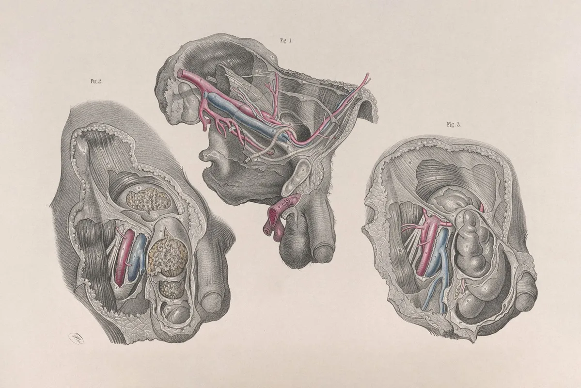 Surgical Anatomy Pl 32 Wall Art by Joseph Maclise - High-Resolution Digital Print