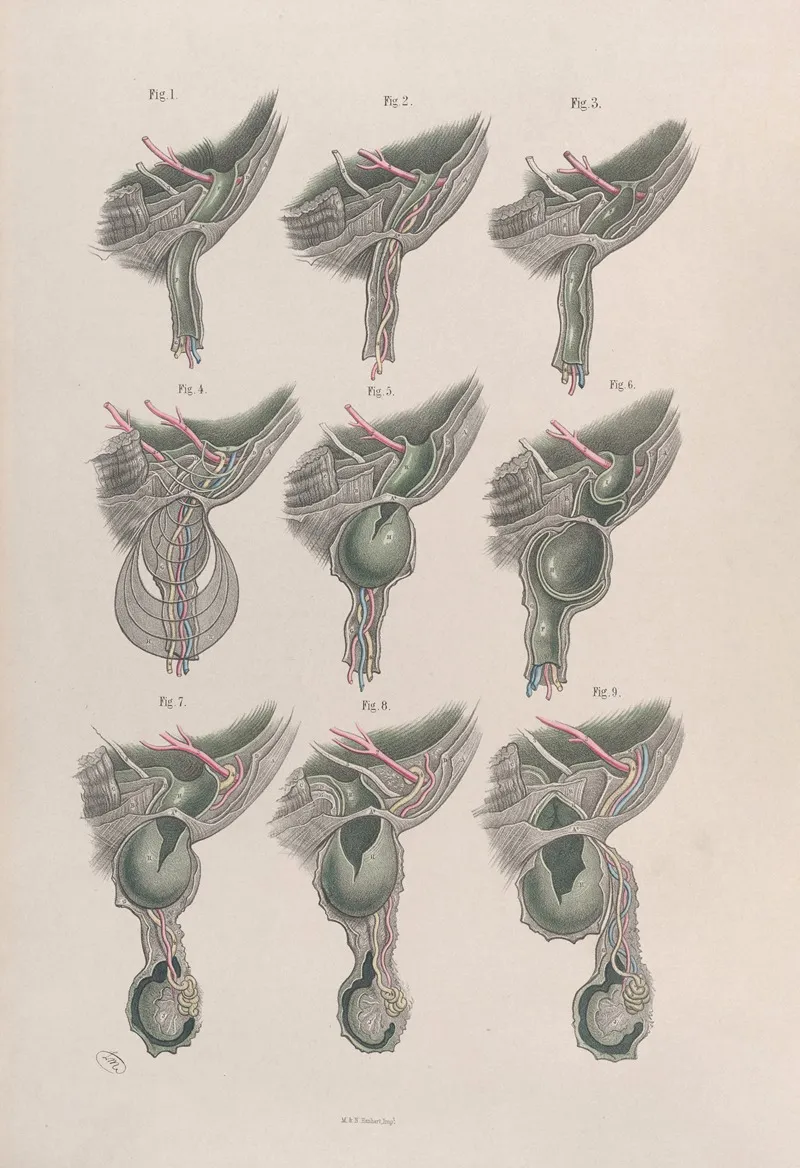 Surgical Anatomy Pl 33 Wall Art by Joseph Maclise - High-Resolution Digital Print