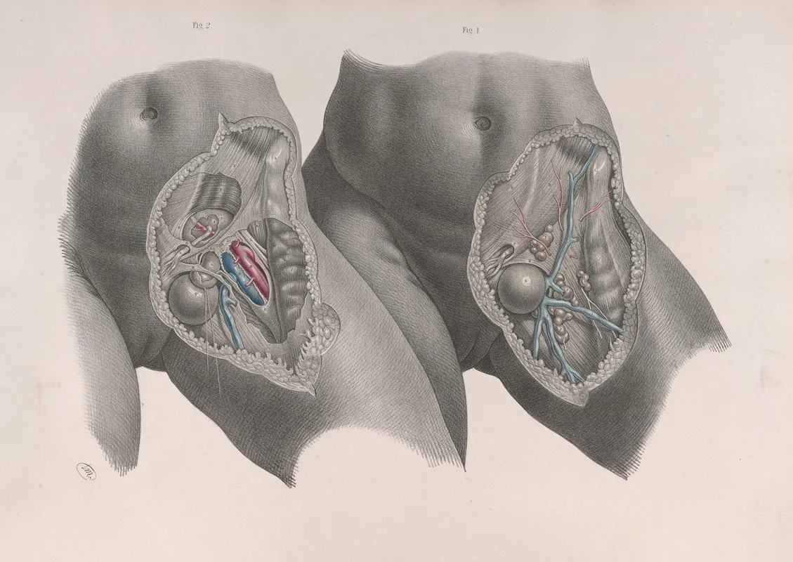 Surgical Anatomy Pl 35 Wall Art by Joseph Maclise - High-Resolution Digital Print