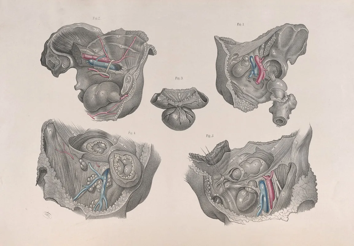 Surgical Anatomy Pl 36 Wall Art by Joseph Maclise - High-Resolution Digital Print
