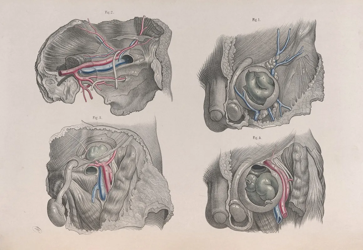 Surgical Anatomy Pl 37 Wall Art by Joseph Maclise - High-Resolution Digital Print