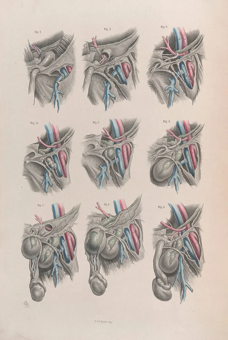 Surgical Anatomy Pl 38 Wall Art by Joseph Maclise - High-Resolution Digital Print