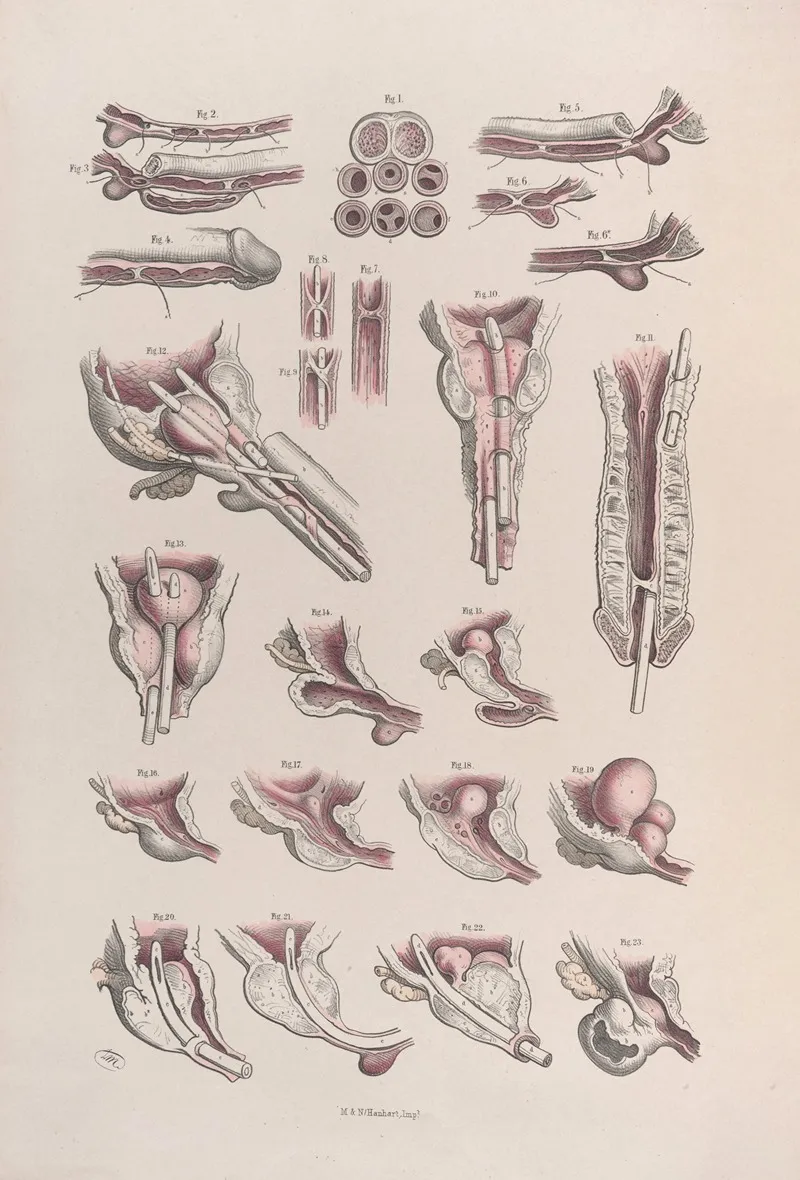 Surgical Anatomy Pl 45 Wall Art by Joseph Maclise - High-Resolution Digital Print