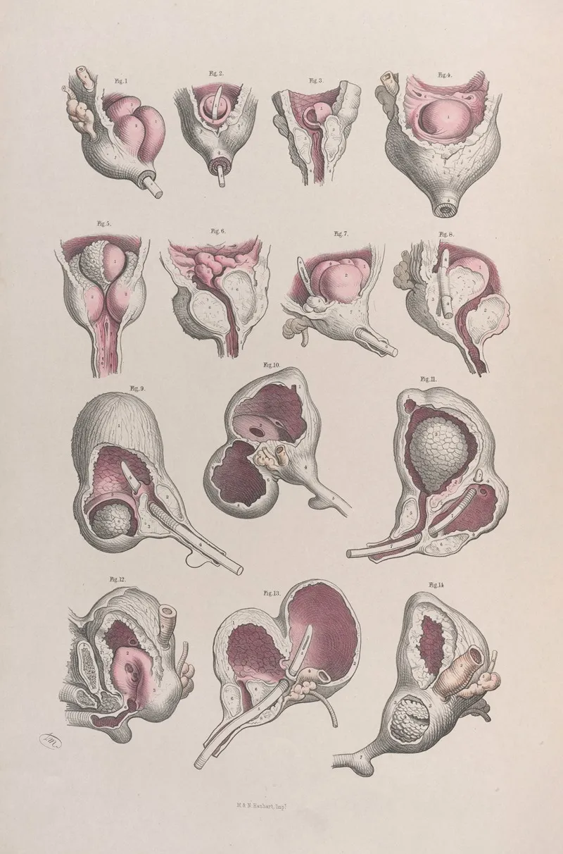 Surgical Anatomy Pl 46 Wall Art by Joseph Maclise - High-Resolution Digital Print