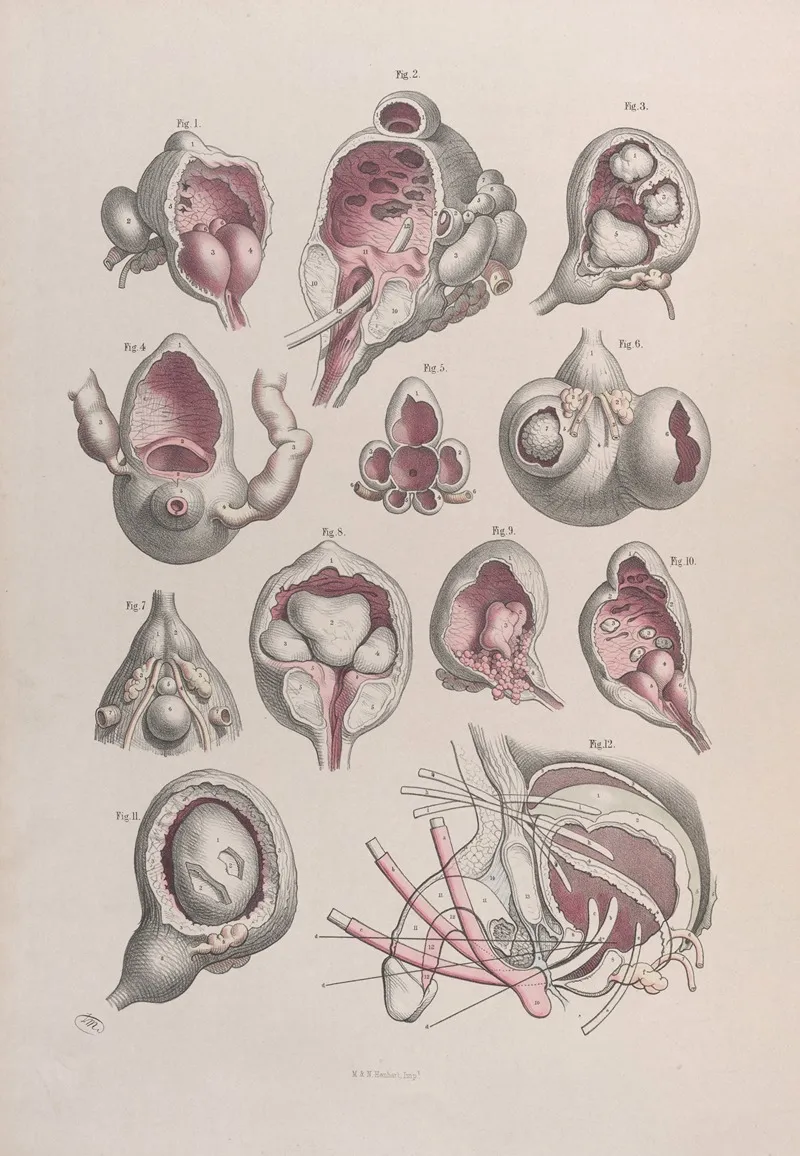 Surgical Anatomy Pl 47 Wall Art by Joseph Maclise - High-Resolution Digital Print