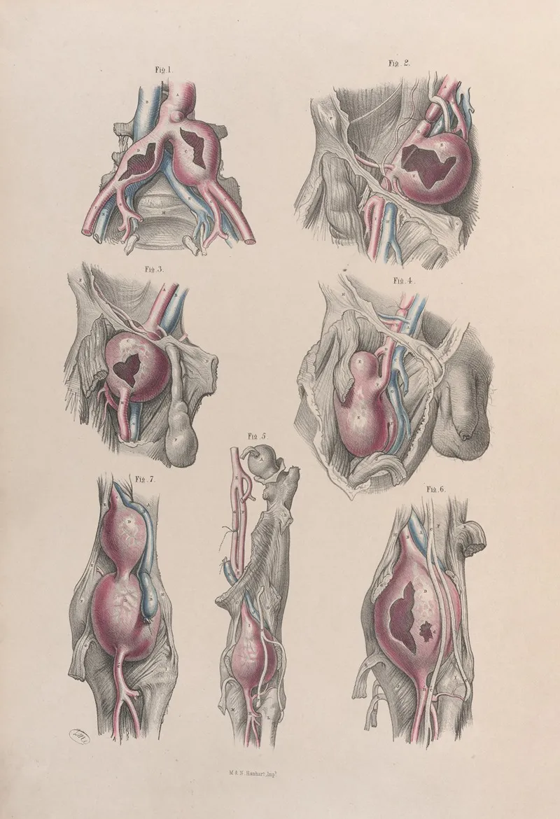 Surgical Anatomy Pl 52 Wall Art by Joseph Maclise - High-Resolution Digital Print