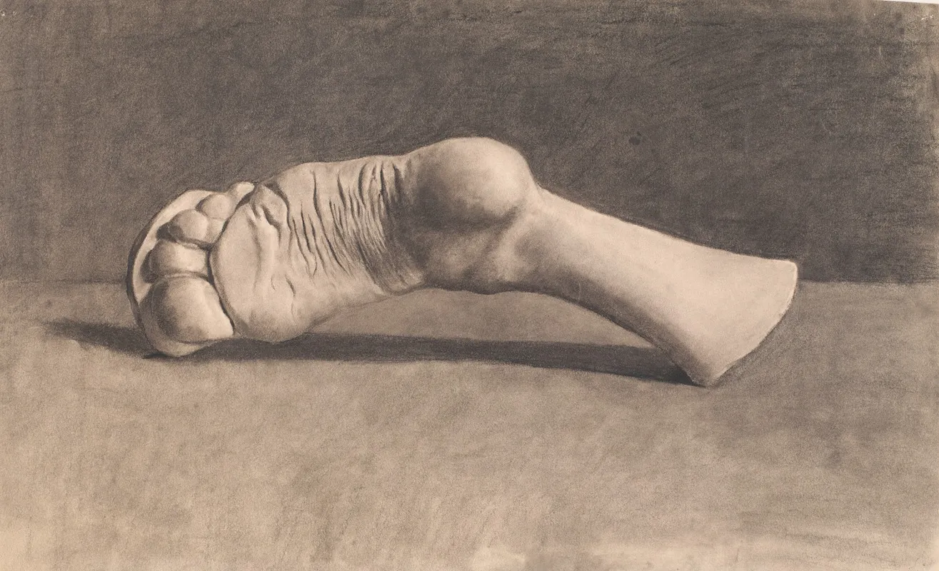 Tegning Efter Gips En Fod