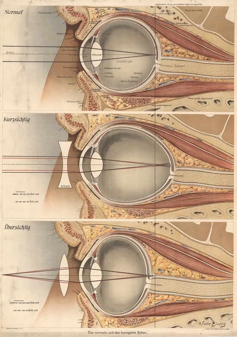 The Eye 2