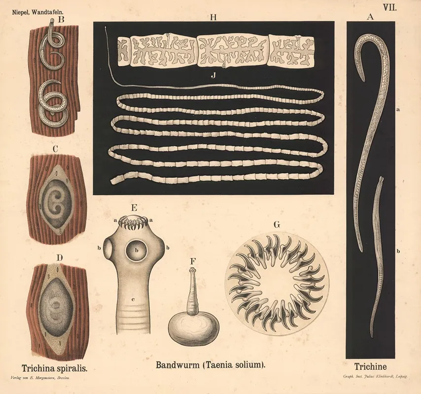 Trichina Spiralis Bandwurm Taenia Solium Trichine Wall Art by Julius Klinkhardt - High-Resolution Digital Print