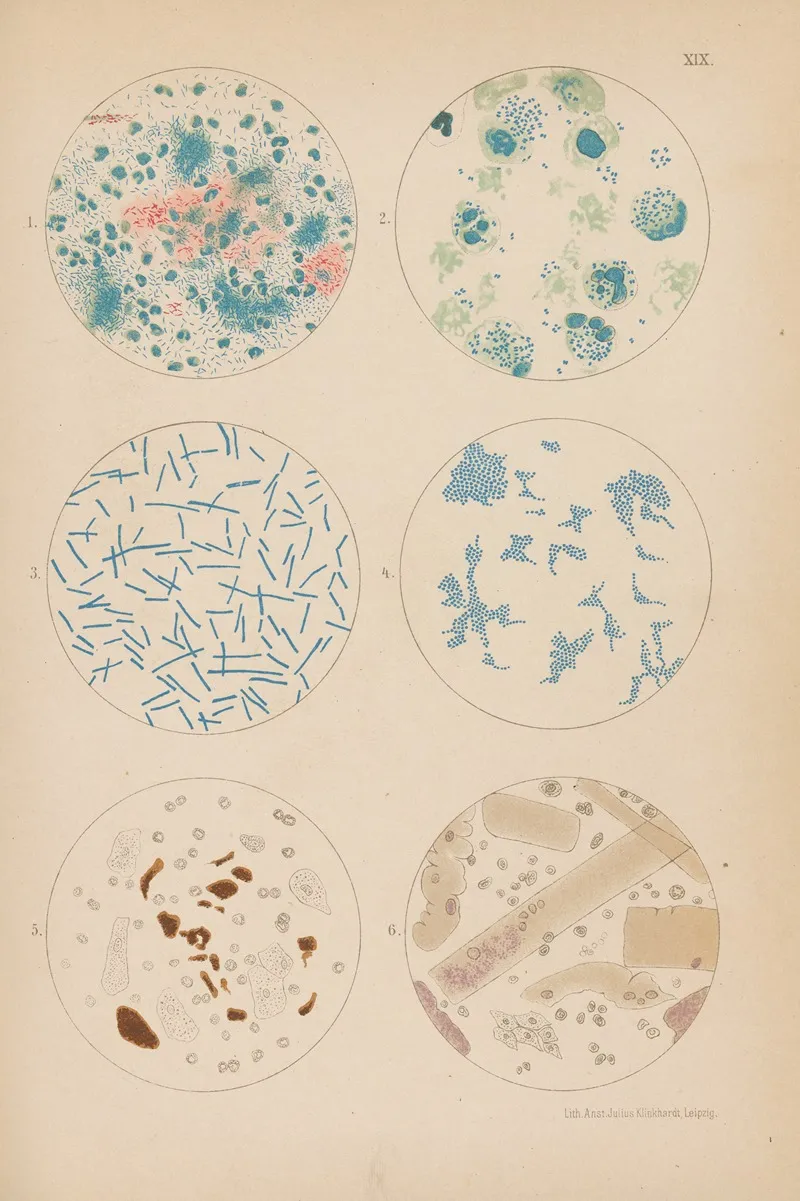 Tubercle Bacilli And Other Bacterium Wall Art by Hermann Rieder - High-Resolution Digital Print