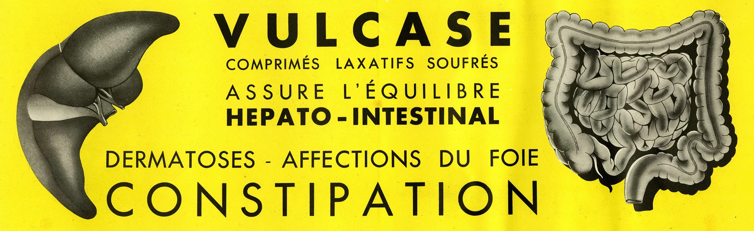 Vulcase 8 Wall Art by Laboratoires Brisson - High-Resolution Digital Print