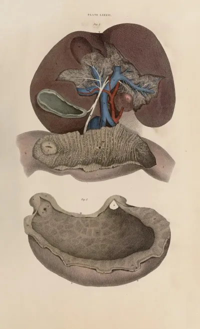 A System Of Anatomical Plates Of The Human Body Pl 089