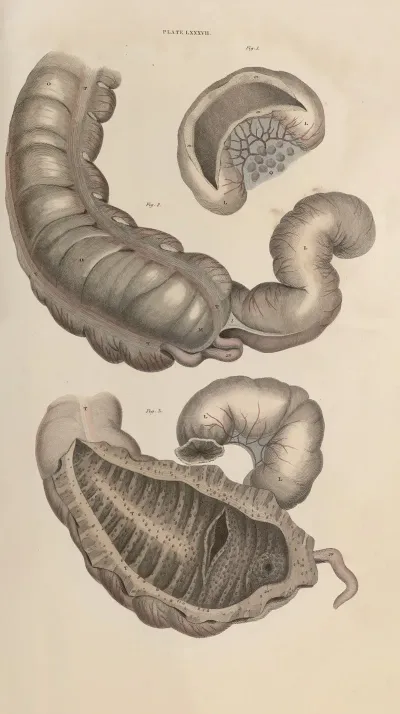 A System Of Anatomical Plates Of The Human Body Pl 090