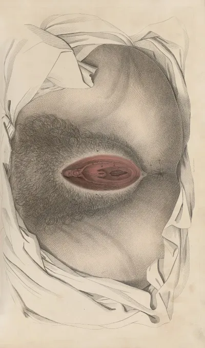 A System Of Anatomical Plates Of The Human Body Pl 094