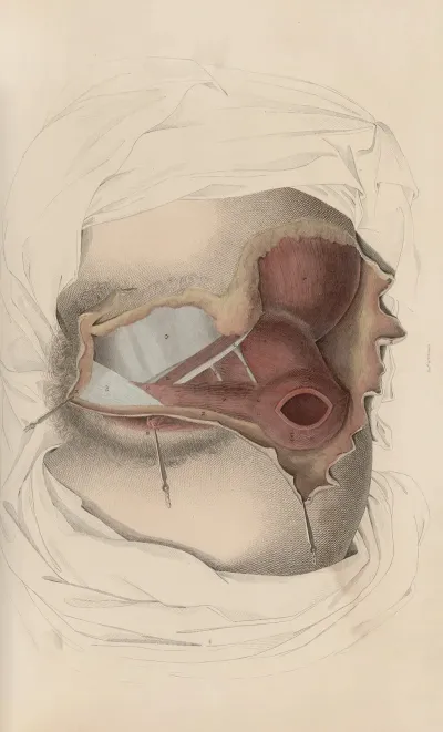 A System Of Anatomical Plates Of The Human Body Pl 095