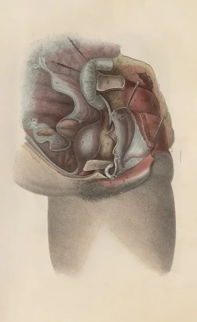 A System Of Anatomical Plates Of The Human Body Pl 096