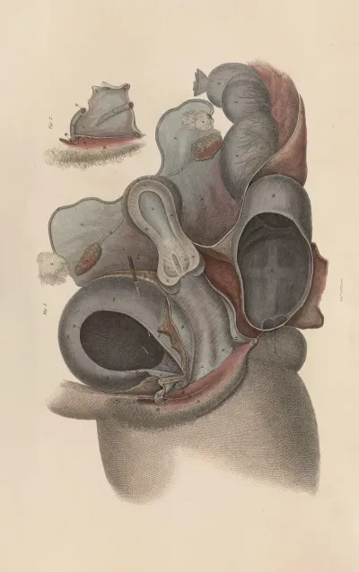 A System Of Anatomical Plates Of The Human Body Pl 097