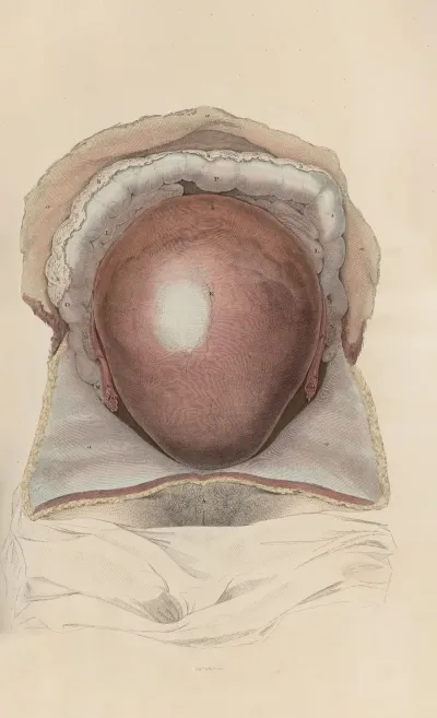 A System Of Anatomical Plates Of The Human Body Pl 098
