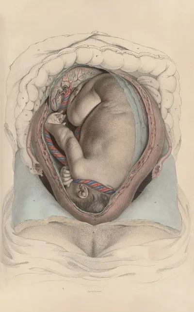 A System Of Anatomical Plates Of The Human Body Pl 099
