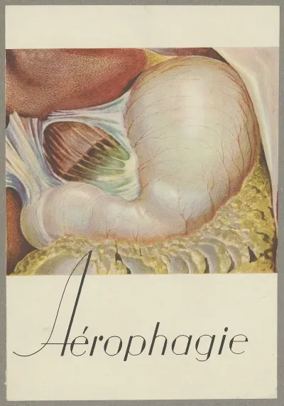 Aerophagie 2