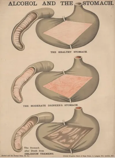 Alcohol And The Stomach